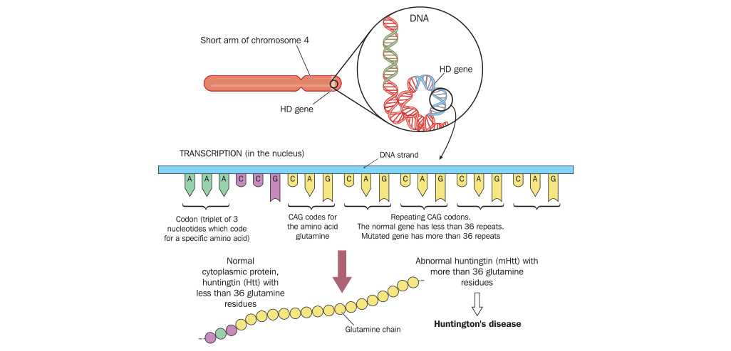 huntington-s-disease-gene