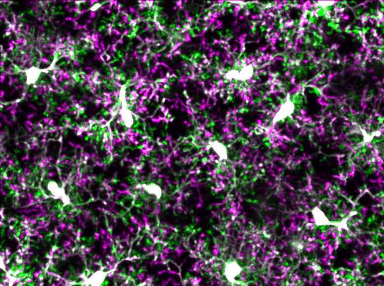 University of Rochester School of Medicine and Dentistry: Modulating the Brain’s Immune System May Curb Damage in Alzheimer’s
